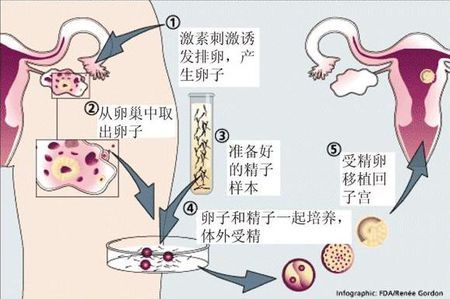 着床障害